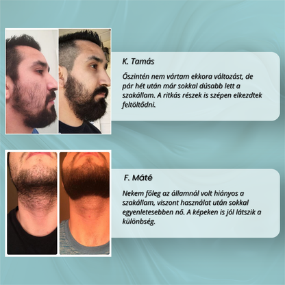 Gentleman's Beard - Szakállnövesztő formula